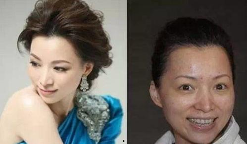 爆料娱乐圈整容,揭秘明星整容真相与争议